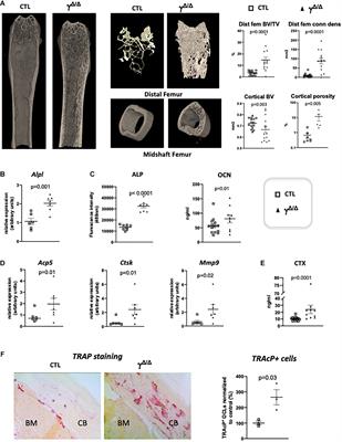 Lack of Adiponectin Drives Hyperosteoclastogenesis in Lipoatrophic Mice